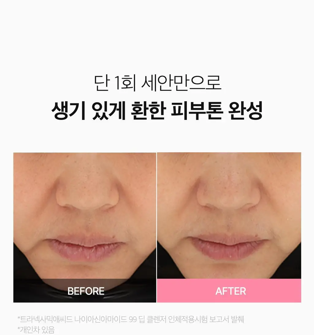 [피지뽑는] 에이프릴스킨 트라넥삼산 딥클렌저 120g 기획 (+15g 미니어처) 상세페이지 27